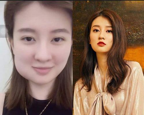 明星拔牙吗,揭秘明星口腔健康秘密